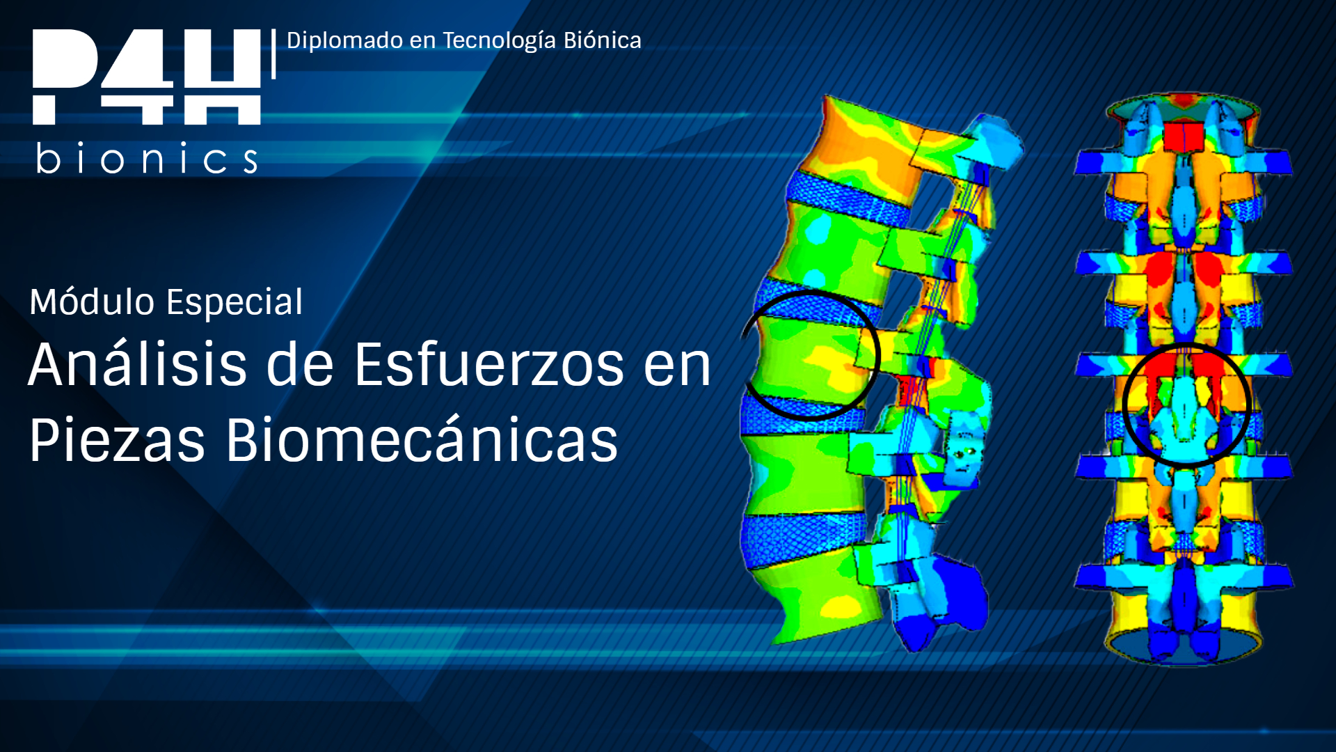 Imagen de producto para (Fase 10.2) Análisis de Esfuerzos en Piezas Biomecánicas